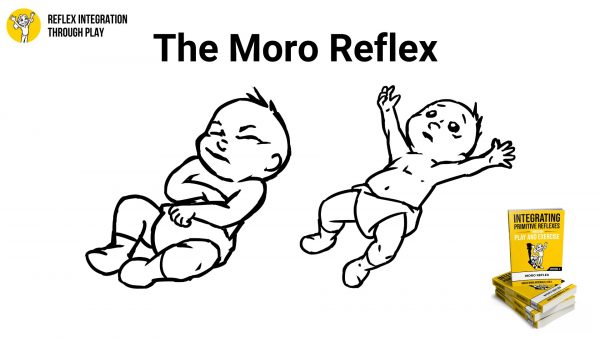 The Moro Reflex Key To Infant Survival And Development Reflex Integration Through Play 